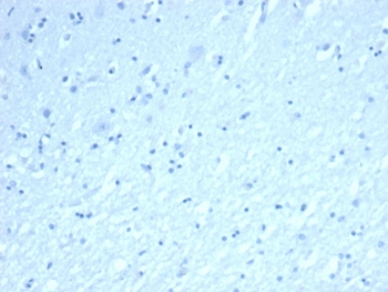 Negative control: IHC staining of FFPE human brain tissue using recombinant INHA antibody (clone INHA/6598R) at 2ug/ml in PBS for 30min RT. HIER: boil tissue sections in pH 9 10mM Tris with 1mM EDTA for 20 min and allow to cool before testing.