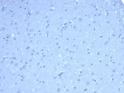 Negative control: IHC staining of FFPE human brain tissue using TOM1L1 antibody (clone TOM1L1/4690) at 2ug/ml in PBS for 30min RT. HIER: boil tissue sections in pH 9 10mM Tris with 1mM EDTA for 20 min and allow to cool before testing.