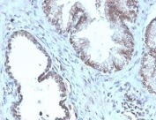 IHC staining of FFPE human prostate tissue with Prostein antibody (clone SLC45A3/4965R). HIER: boil tissue sections in pH 9 10mM Tris with 1mM EDTA for 20 min and allow to cool before testing.