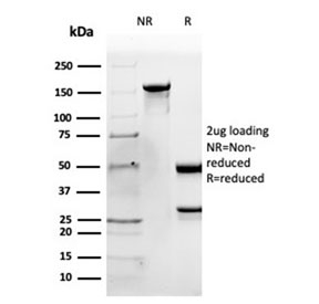 SDS-PAGE analysis of purified, BSA-free Apolipoprotein B antibody (clone APOB/4335) as confirmation of integrity and purity.