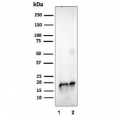 Western blot testing of human 1) JEG-3 and 2 )LNCaP cell lysate using SOD1 antibody (clone SOD1/4329). Predicted molecular weight ~16 kDa.