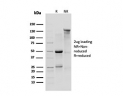 SDS-PAGE analysis of purified, BSA-free recombinant Delta 1 Catenin antibody (CTNND1/4383R) as confirmation of integrity and purity.