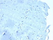 Negative tissue control. IHC analysis of formalin-fixed, paraffin-embedded human brain stained with CTNND1/4383R at 2ug/ml in PBS for 30min RT. HIER: boil tissue sections in pH 9 10mM Tris with 1mM EDTA for 20 min and allow to cool before testing.