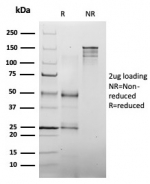SDS-PAGE analysis of purified, BSA-free MLH1 antibody (clone MLH1/6467) as confirmation of integrity and purity.