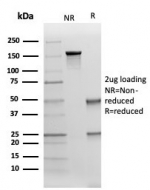SDS-PAGE analysis of purified, BSA-free Cytokeratin 17 antibody (KRT17/4604) as confirmation of integrity and purity.