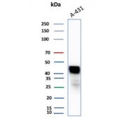Western blot testing of human A431 cell lysate with Cytokeratin 17 antibody. Predicted molecular weight ~48 kDa.