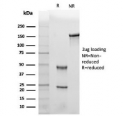 SDS-PAGE analysis of purified, BSA-free Leptin Receptor antibody (clone LEPR/4301) as confirmation of integrity and purity.