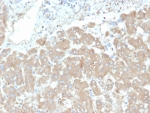 IHC staining of human liver tissue with Leptin Receptor antibody (clone LEPR/4301). HIER: boil tissue sections in pH 9 10mM Tris with 1mM EDTA for 20 min and allow to cool before testing.