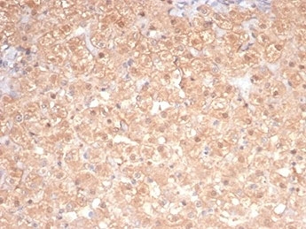 IHC staining of FFPE cat liver tissue with PRKCI antibody (clone PRKCI/4911). HIER: boil tissue sections in pH 9 10mM Tris with 1mM EDTA for 20 min and allow to cool before testing.