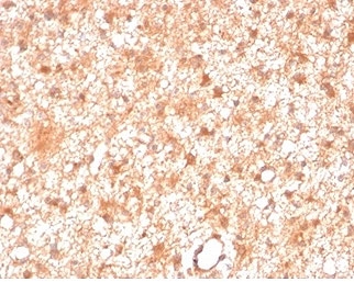 IHC staining of FFPE human brain tissue with PRKCI antibody (clone PRKCI/4911). HIER: boil tissue sections in pH 9 10mM Tris with 1mM EDTA for 20 min and allow to cool before testing.