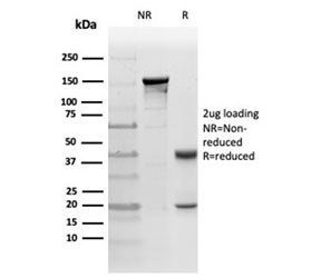 SDS-PAGE analysis of purified, BSA-free PRKCI antibody (clone PRKCI/4911) as confirmation of integrity and purity.