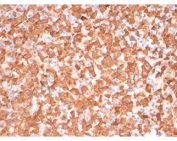 IHC staining of FFPE dog liver tissue with PRKCI antibody (clone PRKCI/4911). HIER: boil tissue sections in pH 9 10mM Tris with 1mM EDTA for 20 min and allow to cool before testing.