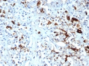 IHC staining of FFPE human pituitary tissue with Prolactin antibody (clone PRL/4908R). HIER: boil tissue sections in pH 9 10mM Tris with 1mM EDTA for 20 min and allow to cool before testing.