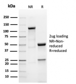 SDS-PAGE analysis of purified, BSA-free Prolactin antibody (clone PRL/4908R) as confirmation of integrity and purity.
