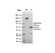 SDS-PAGE analysis of purified, BSA-free recombinant WT1 antibody (clone rWT1/6908) as confirmation of integrity and purity.