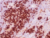 IHC staining of FFPE human tonsil tissue with CD38 antibody (clone CD38/4328) at 2ug/ml in PBS for 30min RT. Strong cytoplasmic and membranous staining is observed. HIER: boil tissue sections in pH 9 10mM Tris with 1mM EDTA for 20 min and allow to cool before testing.