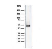 Western blot testing of human Raji cell lysate using CD38 antibody (clone CD38/4328). Expected molecular weight: 34-46 kDa depending on glycosylation level.