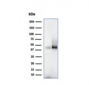 Western blot testing of human 1) spleen and 2) Raji cell lysate using CD38 antibody (clone CD384328). Expected molecular weight: 34-46 kDa depending on glycosylation level.