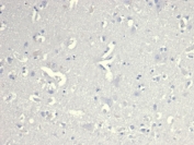 Negative control: IHC staining of FFPE human cerebral cortex tissue with CD38 antibody (clone CD38/4328) at 2ug/ml in PBS for 30min RT. HIER: boil tissue sections in pH 9 10mM Tris with 1mM EDTA for 20 min and allow to cool before testing.