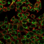 Immunofluorescent staining of human HeLa cells using CTBP2 antibody (green, clone PCRP-CTBP2-1A9) and phalloidin (red).