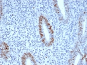 IHC staining of FFPE human endometrium with recombinant CCNE1 antibody (clone CCNE1/4935R). HIER: boil tissue sections in pH 9 10mM Tris with 1mM EDTA for 20 min and allow to cool before testing.