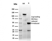 SDS-PAGE analysis of purified, BSA-free recombinant CCNE1 antibody (clone CCNE1/4935R) as confirmation of integrity and purity.