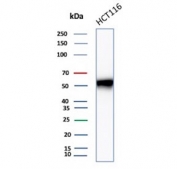 Western blot testing of human HCT-116 cell lysate using recombinant CCNE1 antibody (clone CCNE1/4935R). Predicted molecular weight ~47 kDa.