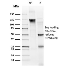 SDS-PAGE analysis of purified, BSA-free MED21 antibody (clone PCRP-MED21-4B5) as confirmation of integrity and purity.