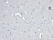 Negative control: IHC staining of FFPE human brain tissue with recombinant CD38 antibody (clone CD38/6448R) at 2ug/ml in PBS for 30min RT. HIER: boil tissue sections in pH 9 10mM Tris with 1mM EDTA for 20 min and allow to cool before testing.