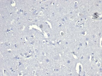 Negative control: IHC staining of FFPE human brain tissue with recombinant CD38 antibody (clone CD38/6448R) at 2ug/ml in PBS for 30min RT. HIER: boil tissue sections in pH 9 10mM Tris with 1mM EDTA for 20 min and allow to cool before testing.