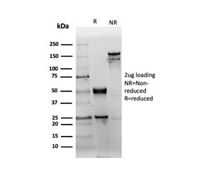 SDS-PAGE analysis of purified, BSA-free recombinant CD38 antibody (clone CD38/6448R) as confirmation of integrity and purity.