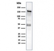 Western blot analysis of human HCT-116 cell lysate using recombinant MSH6 antibody (clone MSH6/6654R). Expected molecular weight: 120-160 kDa depending on phosphorylation level.