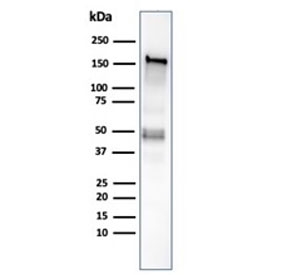 Western blot analysis of human HCT-116 cell lysate using recombinant MSH6 antibody (clone MSH6/6654R). Expected molecular weight: 120-160 kDa depending on phosphorylation level.