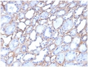 IHC staining of FFPE human kidney tissue with Collagen IV antibody (clone M3F7). HIER: boil tissue sections in pH 9 10mM Tris with 1mM EDTA for 20 min and allow to cool before testing.