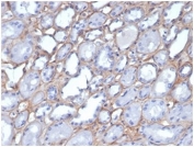 IHC staining of FFPE human kidney tissue with Collagen IV antibody (clone M3F7). HIER: boil tissue sections in pH 9 10mM Tris with 1mM EDTA for 20 min and allow to cool before testing.