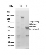 SDS-PAGE analysis of purified, BSA-free ALB antibody (clone ALB/6411R) as confirmation of integrity and purity.
