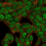 Immunofluorescent staining of human MCF-7 cells using C-terminal-binding protein 2 antibody (green, clone PCRP-CTBP2-2D11) and phalloidin (red).