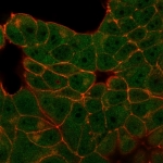 Immunofluorescent staining of PFA-fixed MCF7 cells using E4F1 antibody (green, clone PCRP-E4F1-2D1) and phalloidin (red).