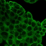 Immunofluorescent staining of PFA-fixed human MCF-7 cells using EIF2A antibody (green, clone PCRP-EIF2S1-1E2).