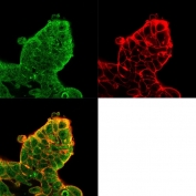 Immunofluorescent staining of PFA-fixed human MCF-7 cells using Eukaryotic translation initiation factor 4E antibody (green, clone PCRP-EIF4E-1D3) and phalloidin (red).
