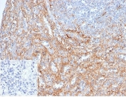 IHC staining of FFPE human spleen tissue with ICAM1 antibody (clone ICAM1/6917). Negative control inset: PBS instead of primary antibody to control for secondary binding. HIER: boil tissue sections in pH 9 10mM Tris with 1mM EDTA for 20 min and allow to cool before testing.