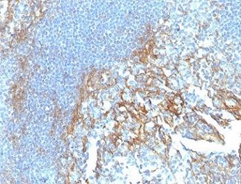 IHC staining of FFPE human tonsil tissue with ICAM-1 antibody (clone ICAM1/6917). HIER: boil tissue sections in pH 9 10mM Tris with 1mM EDTA for 20 min and allow to cool before testing.~