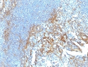 IHC staining of FFPE human tonsil tissue with ICAM-1 antibody (clone ICAM1/6917). HIER: boil tissue sections in pH 9 10mM Tris with 1mM EDTA for 20 min and allow to cool before testing.