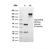 SDS-PAGE analysis of purified, BSA-free recombinant Albumin antibody (clone rALB/6412) as confirmation of integrity and purity.