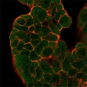 Immunofluorescent staining of PFA-fixed human MCF-7 cells BTF2 p44 antibody (green, clone PCRP-GTF2H2-1B9) and phalloidin (red).