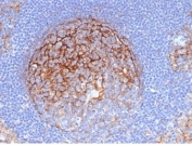 IHC staining of FFPE human lymph node tissue with ICAM1 antibody (clone ICAM1/6319). HIER: boil tissue sections in pH 9 10mM Tris with 1mM EDTA for 20 min and allow to cool before testing.