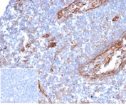 IHC staining of FFPE human tonsil tissue with ICAM1 antibody (clone ICAM1/6319) at 2ug/ml. Negative control inset: PBS instead of primary antibody to control for secondary binding. HIER: boil tissue sections in pH 9 10mM Tris with 1mM EDTA for 20 min and allow to cool before testing.