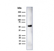 Western blot testing of human MCF-7 cell lysate using IRF3 antibody (clone PCRP-IRF3-1E11). Predicted molecular weight ~47 kDa.