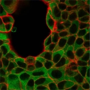 Immunofluorescent staining of human MCF-7 cells using IRF3 antibody (green, clone PCRP-IRF3-6C8) and phalloidin (red).