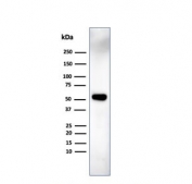 Western blot testing of human MCF7 cell lysate using IRF3 antibody (clone PCRP-IRF3-6C8). Predicted molecular weight ~47 kDa.